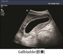 Gallbladder(담낭)